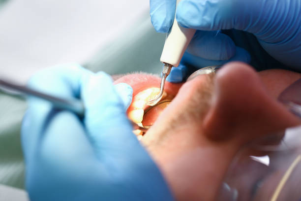 Best Same-Day Emergency Dentist in Clksville, AR