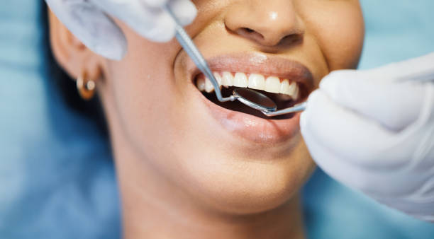 Best Emergency Tooth Extraction in Clksville, AR