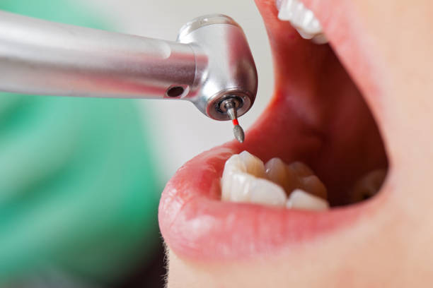 Best Walk-In Emergency Dentist in Clksville, AR